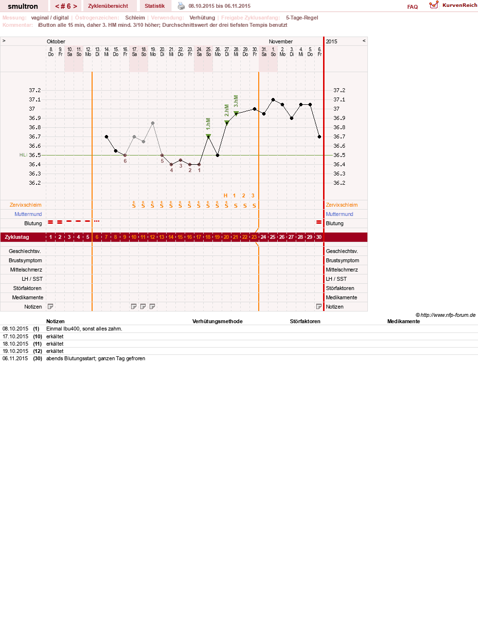 NFP-Kurve User #587
