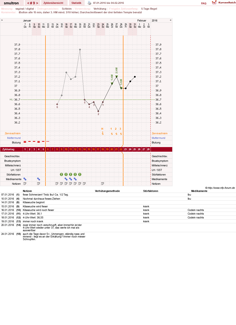 NFP-Kurve User #587