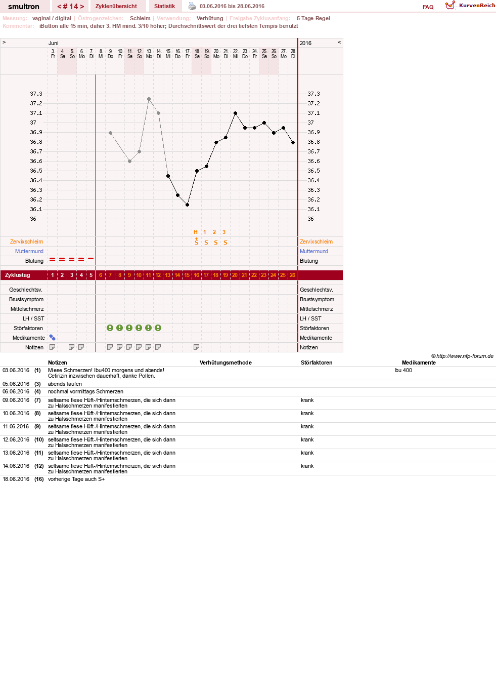 NFP-Kurve User #587