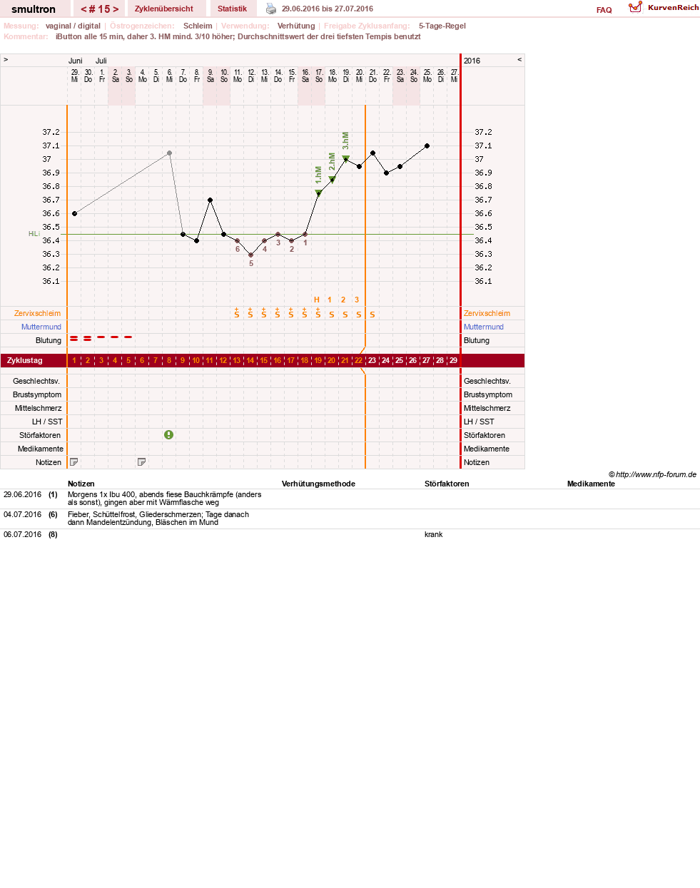NFP-Kurve User #587