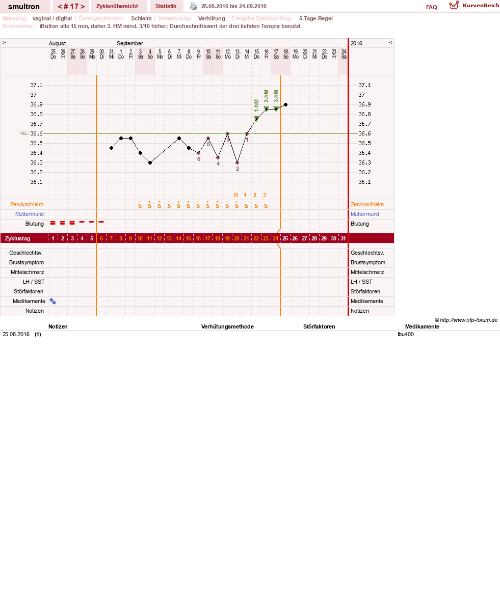 NFP-Kurve User #587