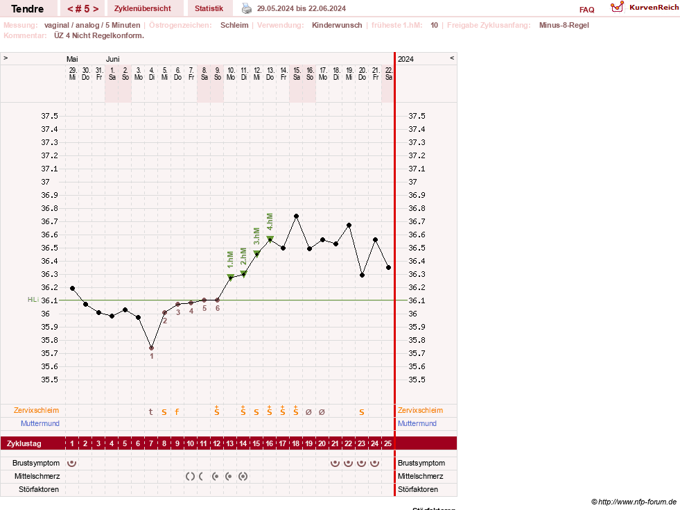 NFP-Kurve User #6031