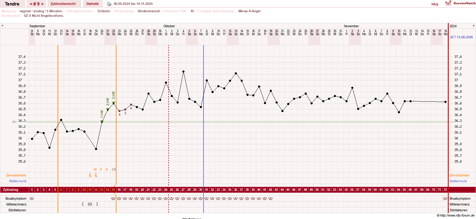 NFP-Kurve User #6031