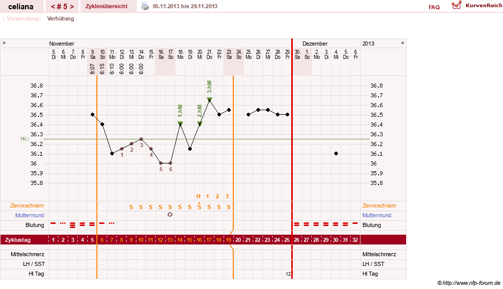 NFP-Kurve User #6200