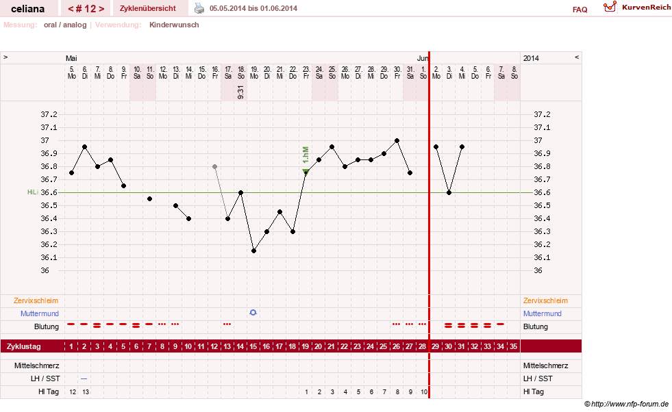 NFP-Kurve User #6200