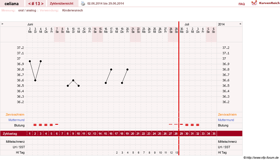 NFP-Kurve User #6200