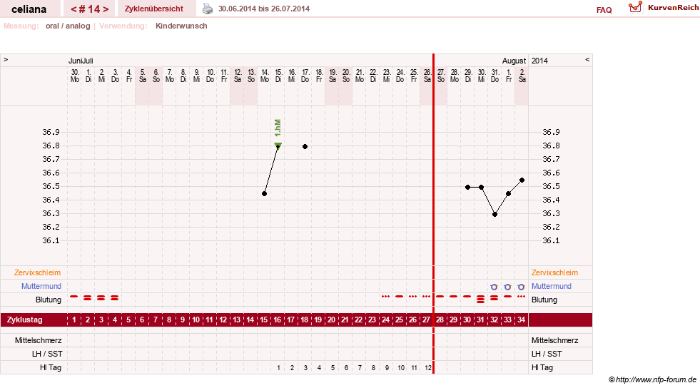 NFP-Kurve User #6200