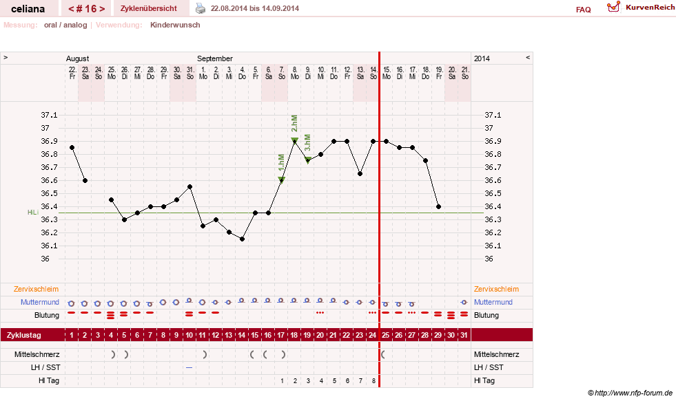 NFP-Kurve User #6200