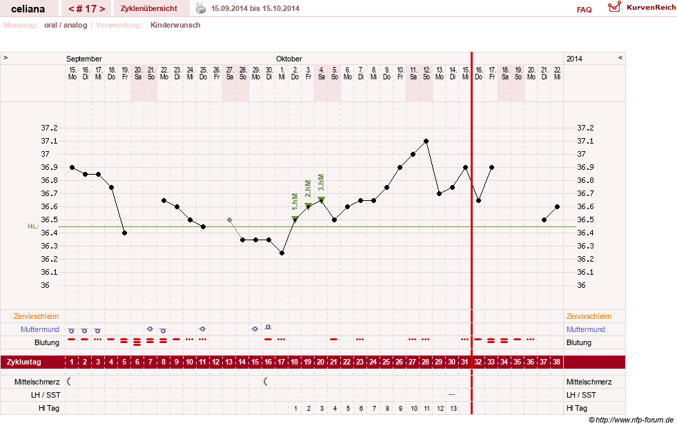 NFP-Kurve User #6200