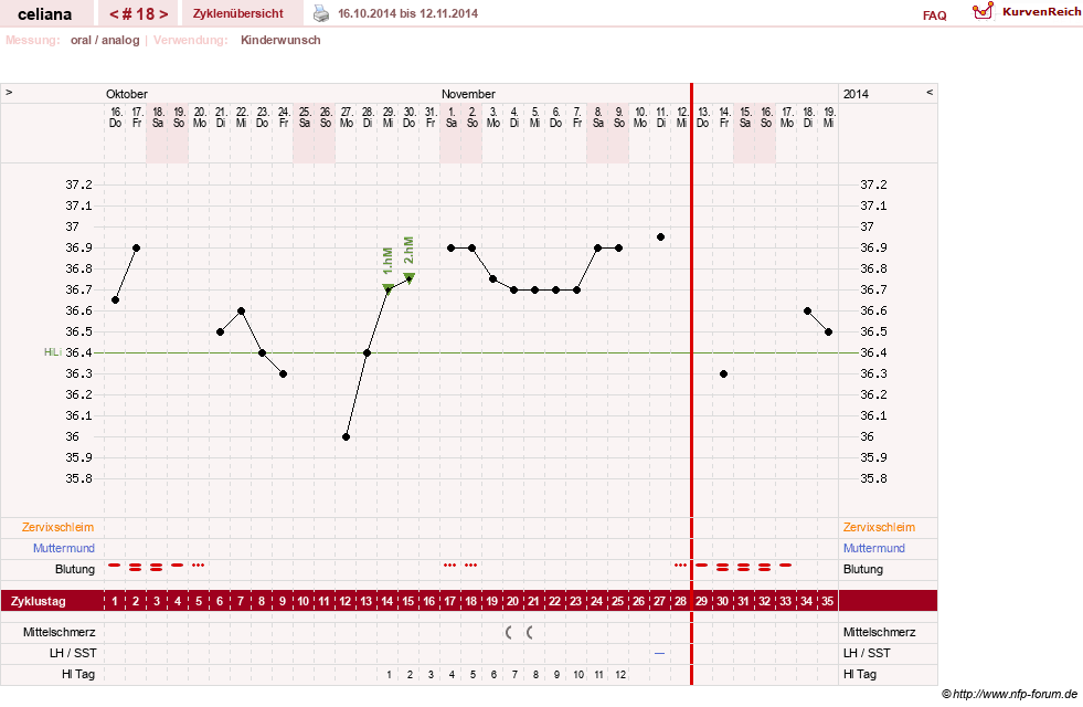 NFP-Kurve User #6200