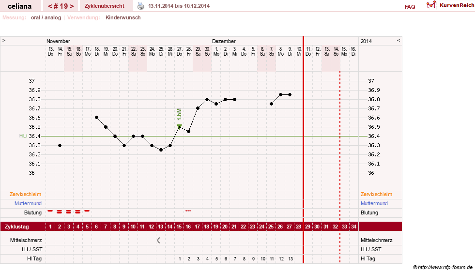NFP-Kurve User #6200
