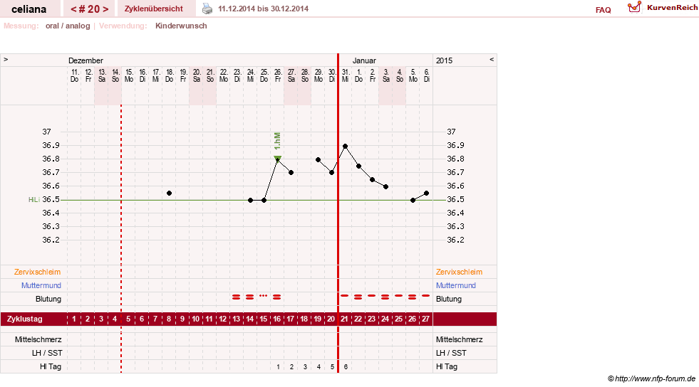 NFP-Kurve User #6200