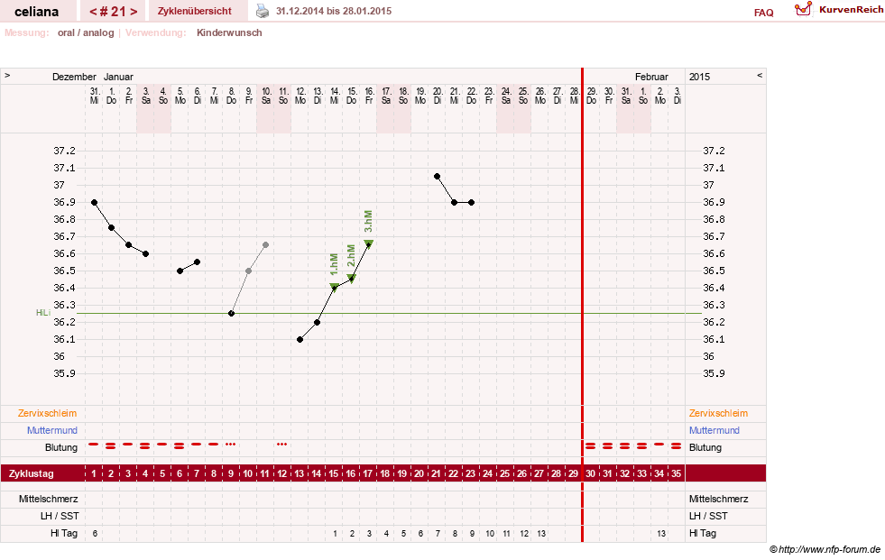 NFP-Kurve User #6200