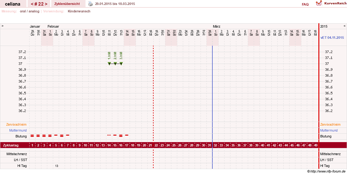 NFP-Kurve User #6200