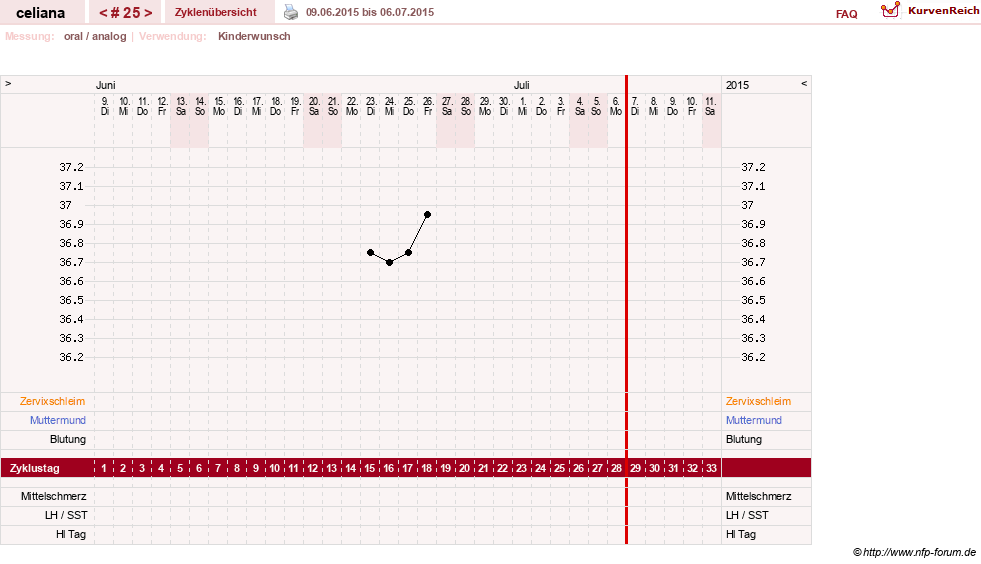 NFP-Kurve User #6200