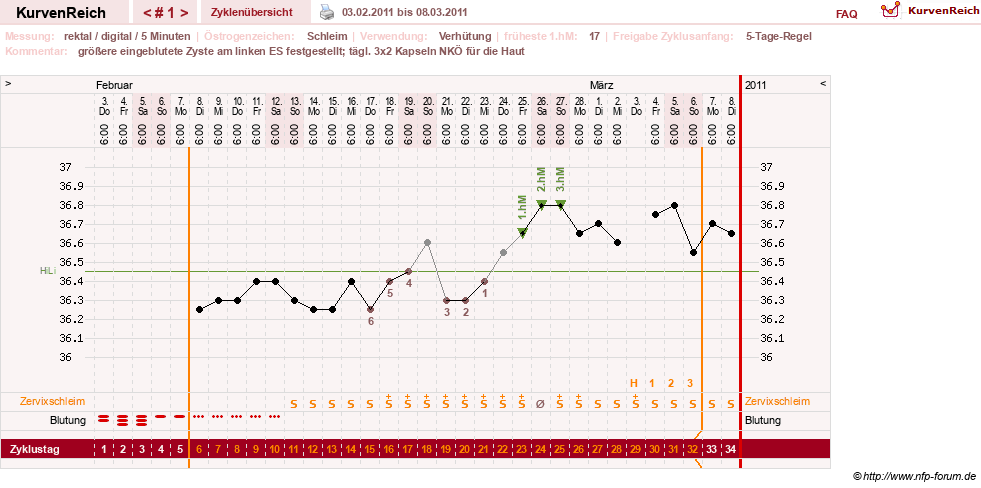 NFP-Kurve User #6740