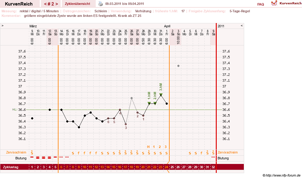 NFP-Kurve User #6740