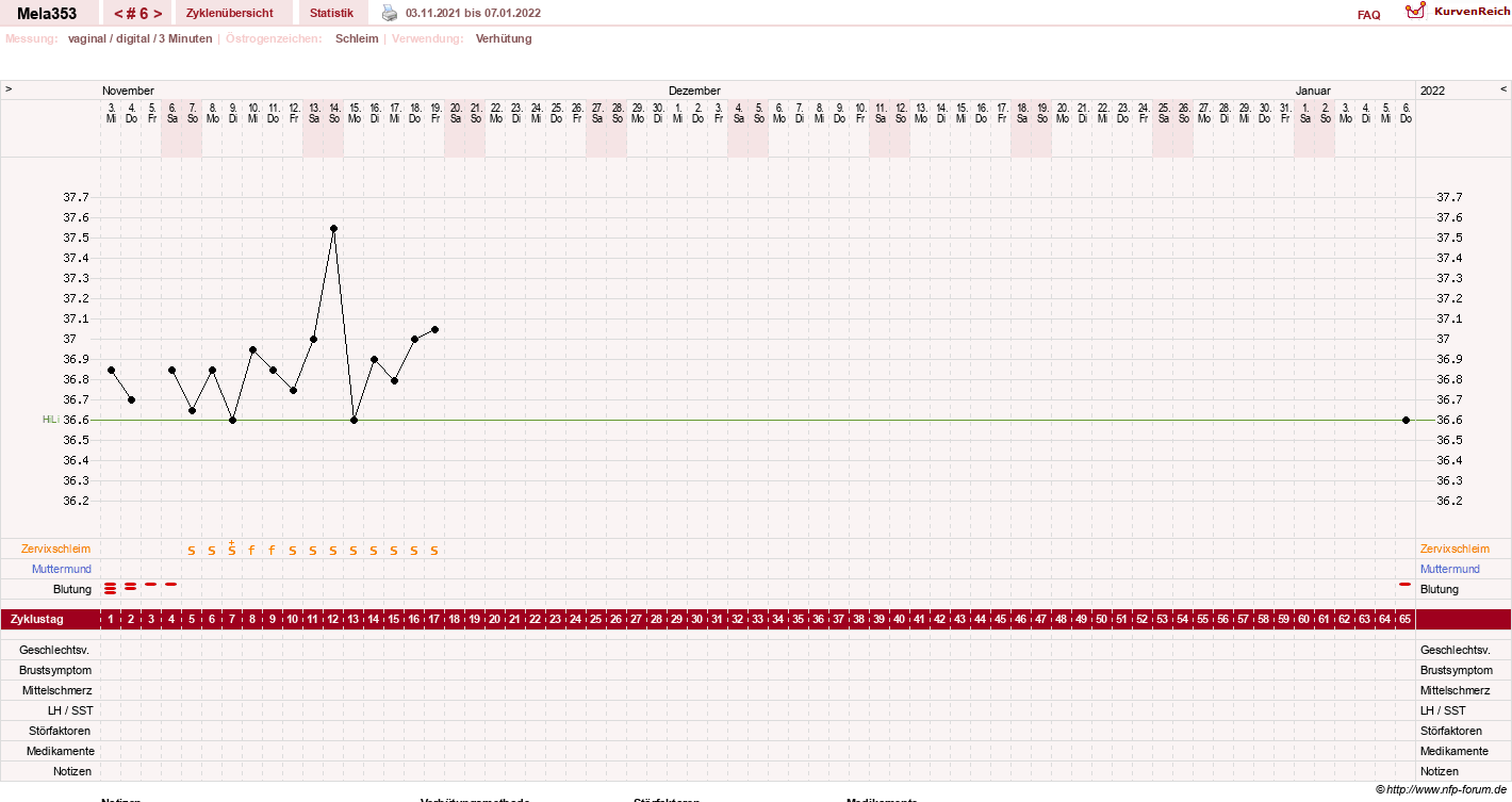 NFP-Kurve User #68461