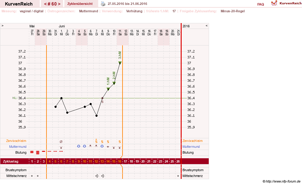 NFP-Kurve User #6881