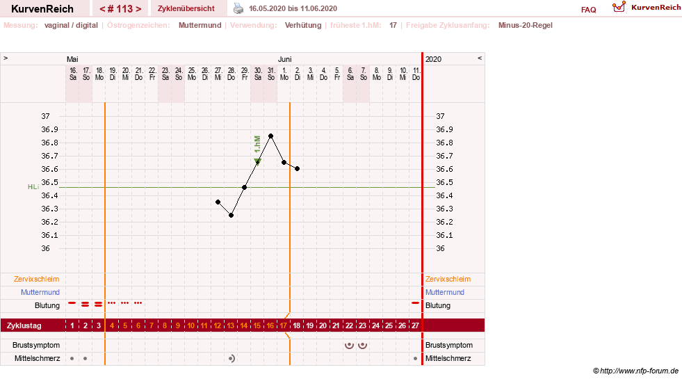 NFP-Kurve User #6881