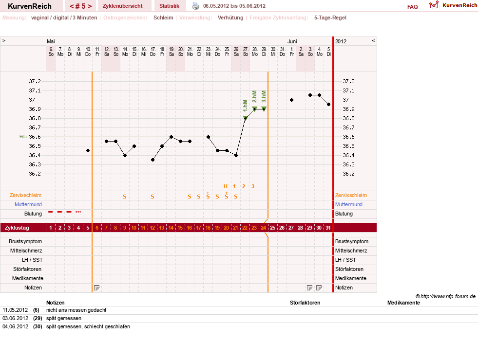 NFP-Kurve User #7684