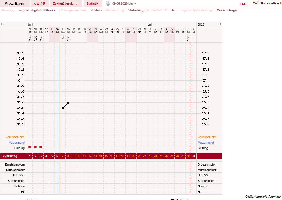 NFP-Kurve User #77962