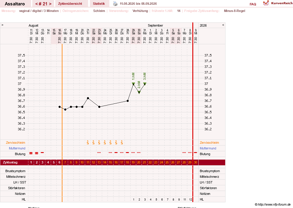 NFP-Kurve User #77962