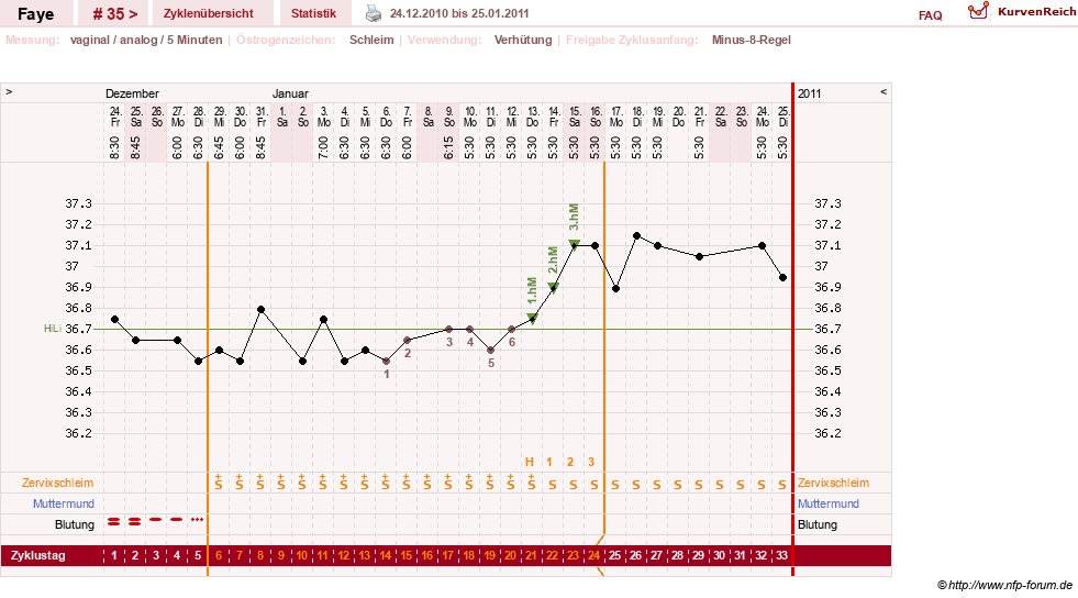 NFP-Kurve User #7798