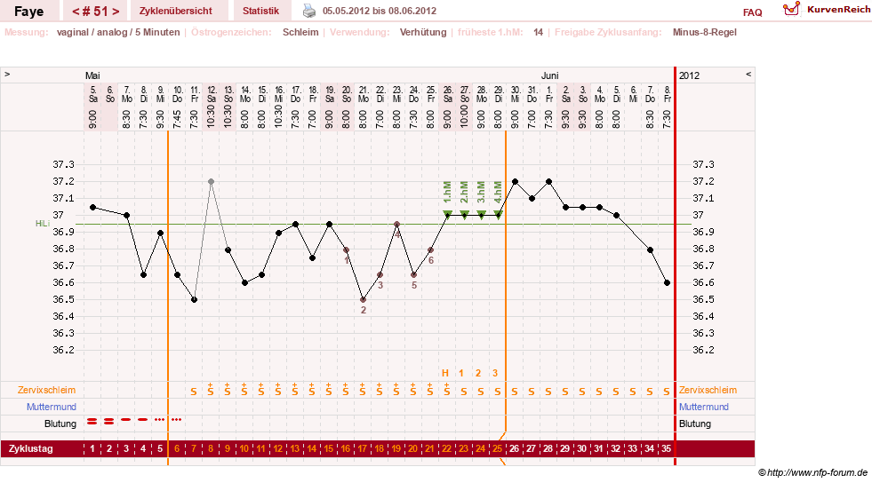 NFP-Kurve User #7798