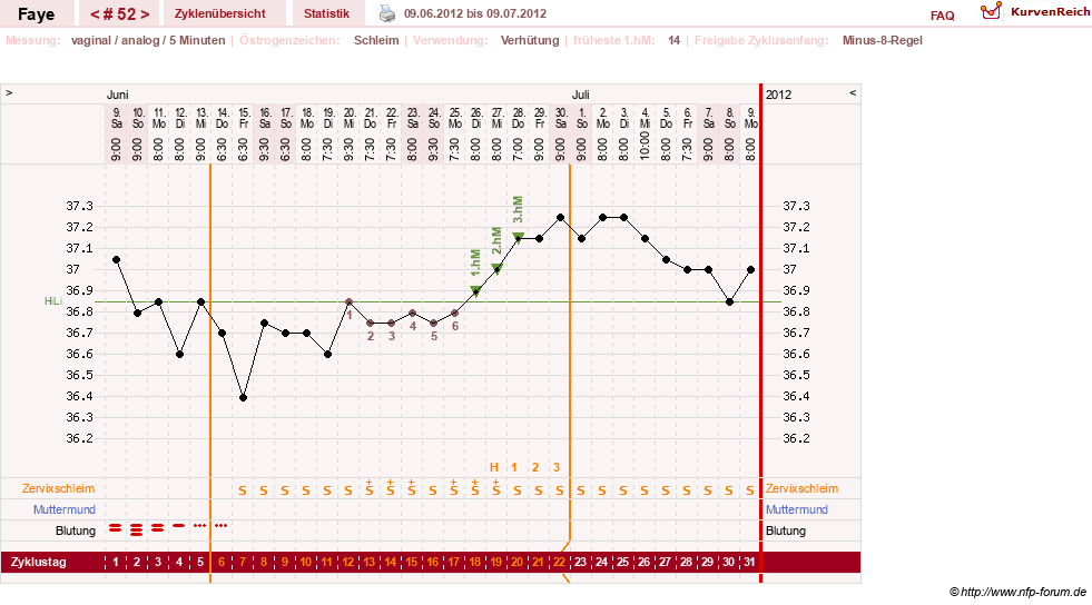 NFP-Kurve User #7798
