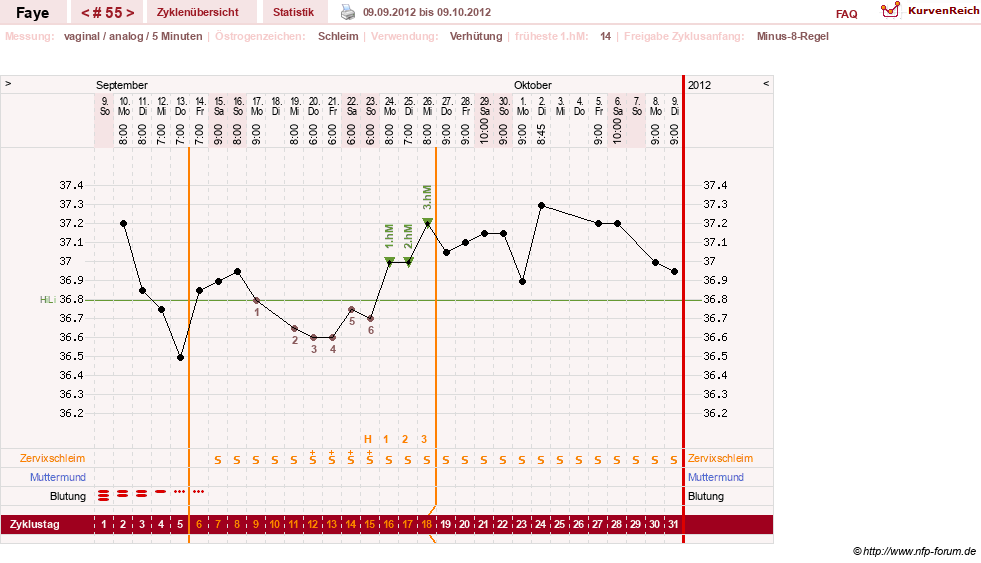 NFP-Kurve User #7798
