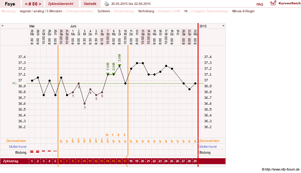 NFP-Kurve User #7798