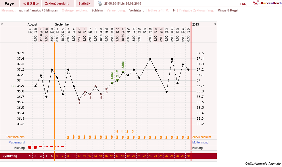 NFP-Kurve User #7798