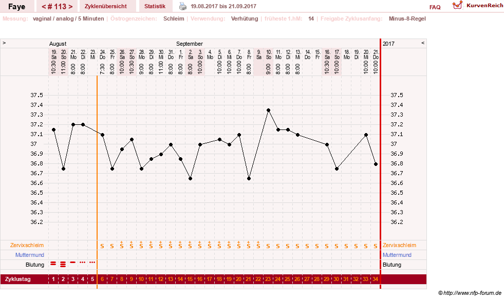 NFP-Kurve User #7798