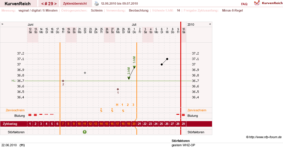 NFP-Kurve User #7842