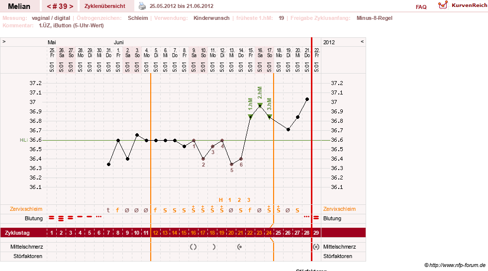 NFP-Kurve User #7884