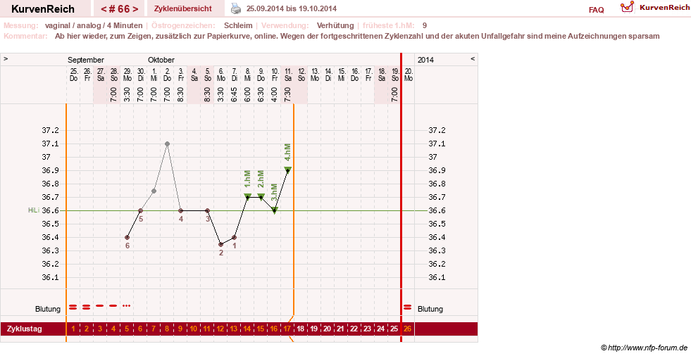 NFP-Kurve User #8208