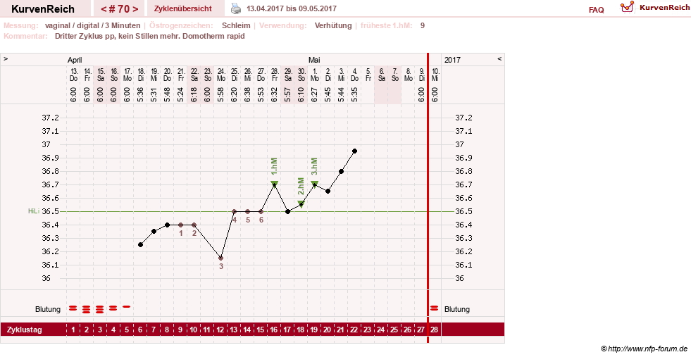 NFP-Kurve User #8208