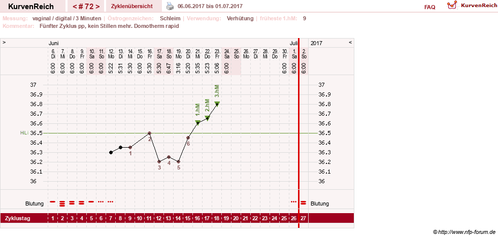 NFP-Kurve User #8208