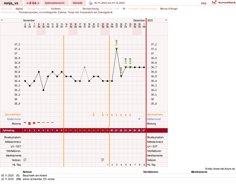 NFP-Kurve User #8708
