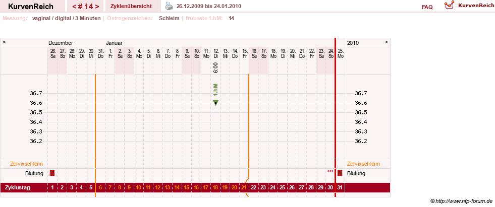 NFP-Kurve User #9764