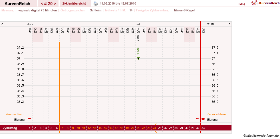NFP-Kurve User #9764