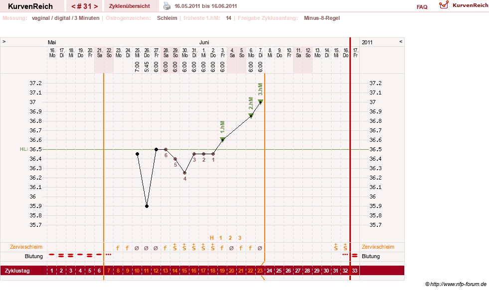 NFP-Kurve User #9764