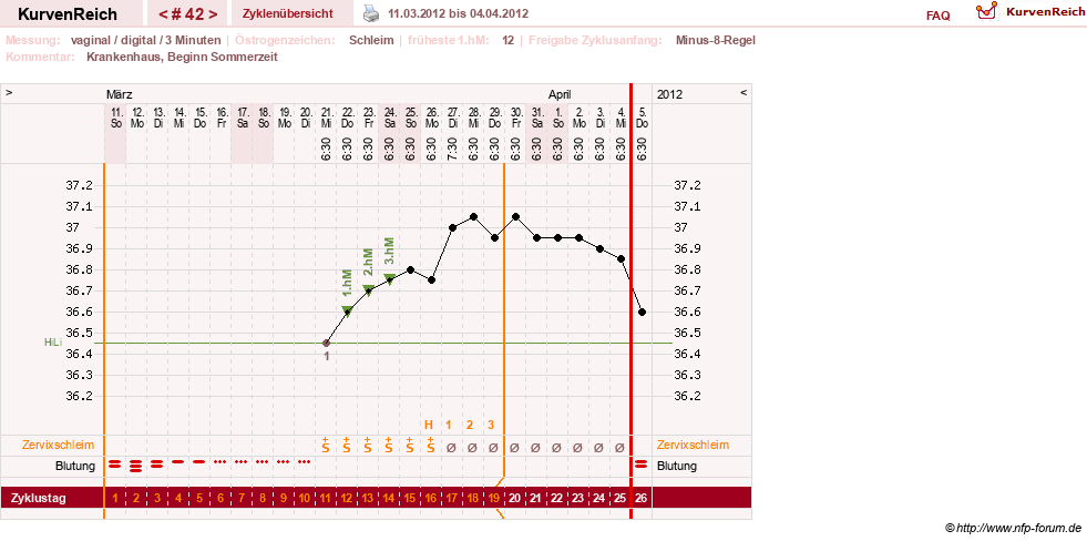 NFP-Kurve User #9764