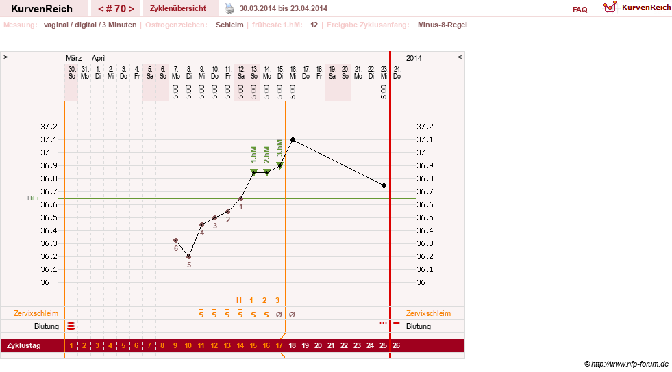 NFP-Kurve User #9764