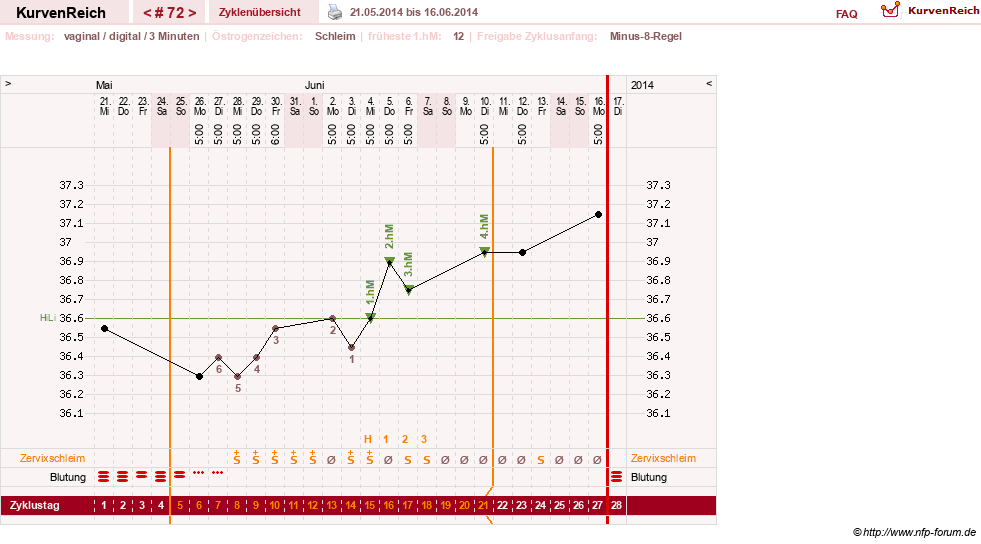 NFP-Kurve User #9764
