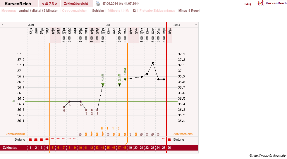 NFP-Kurve User #9764