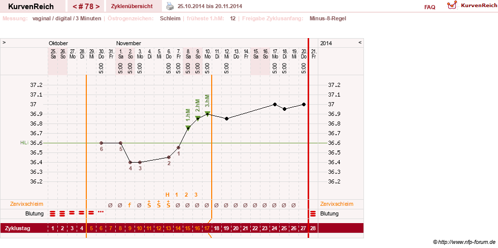 NFP-Kurve User #9764