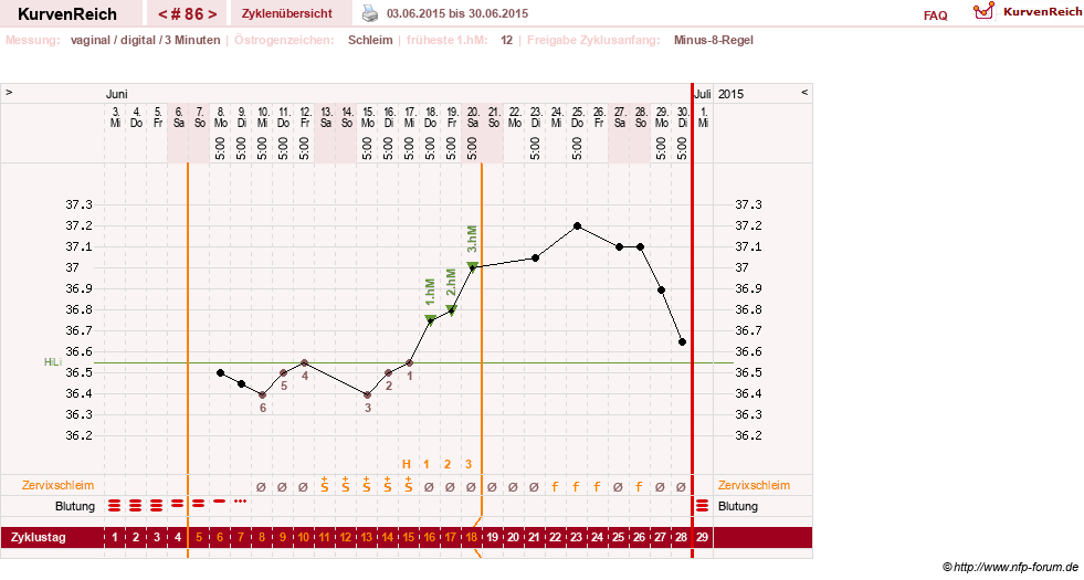NFP-Kurve User #9764