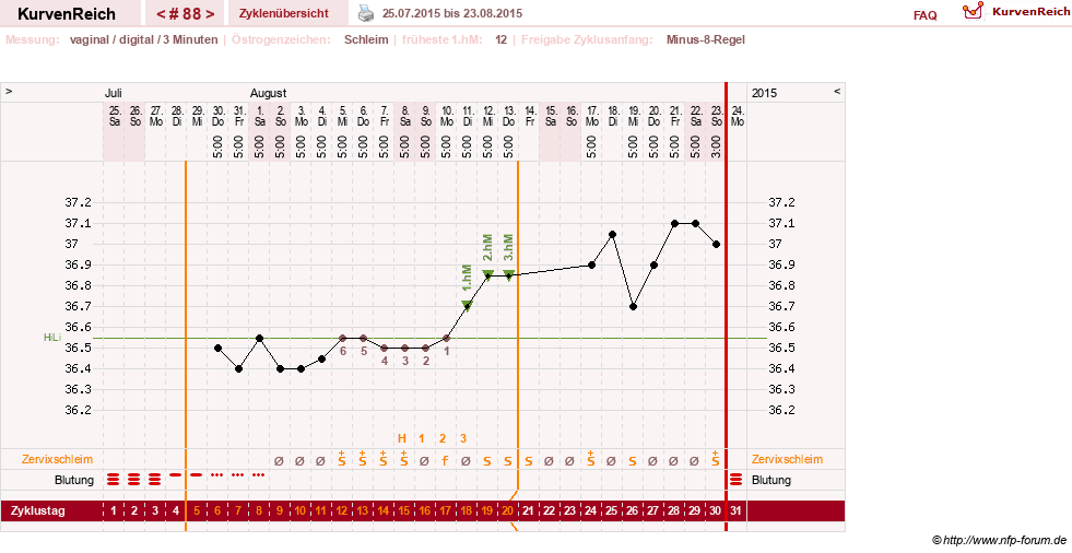 NFP-Kurve User #9764